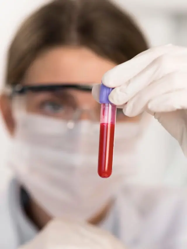 Hematology Tests and Diagnosis
