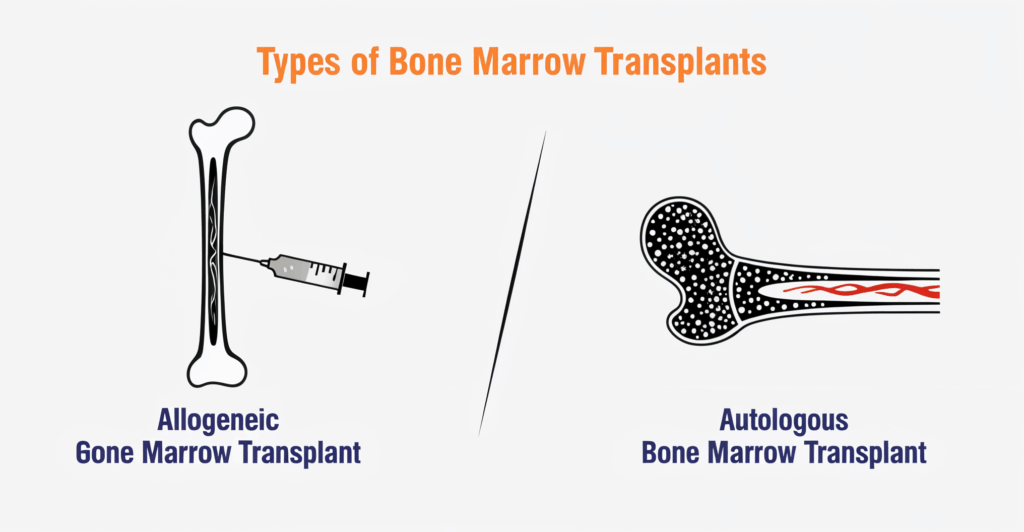 Best Bone Marrow Transplant Hospital in India